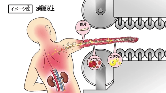 労働安全衛生カテゴリ